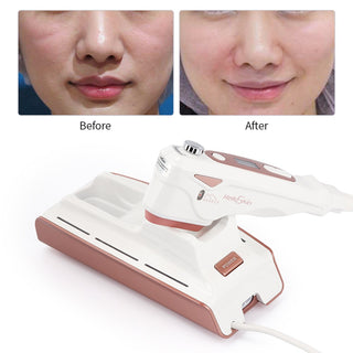 Home V Face Lifting Ultrasonic Knife Lifting Anti-aging Beauty Instrument